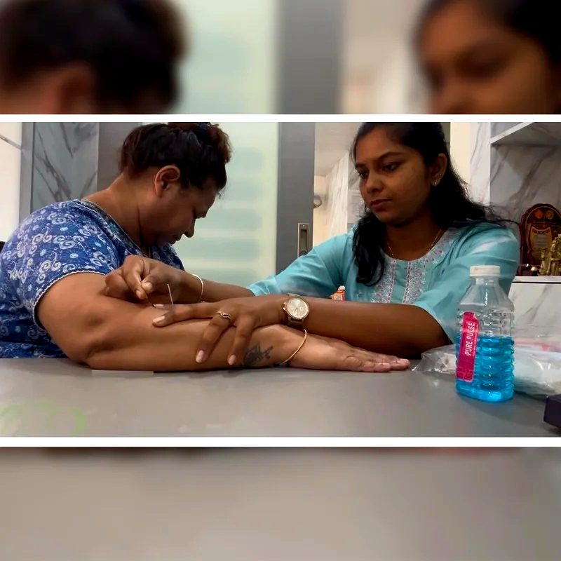Dry Needling at AARROSH Clinic